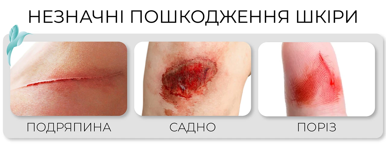 Як виглядає подряпина на тілі, садно фото, поріз фото