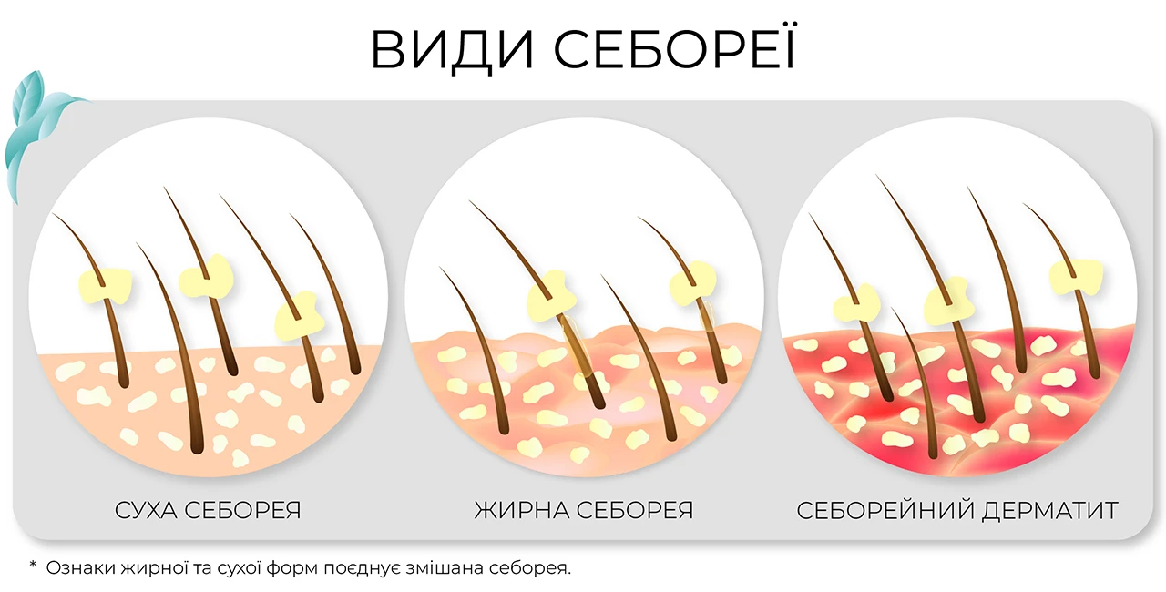 Види себореї